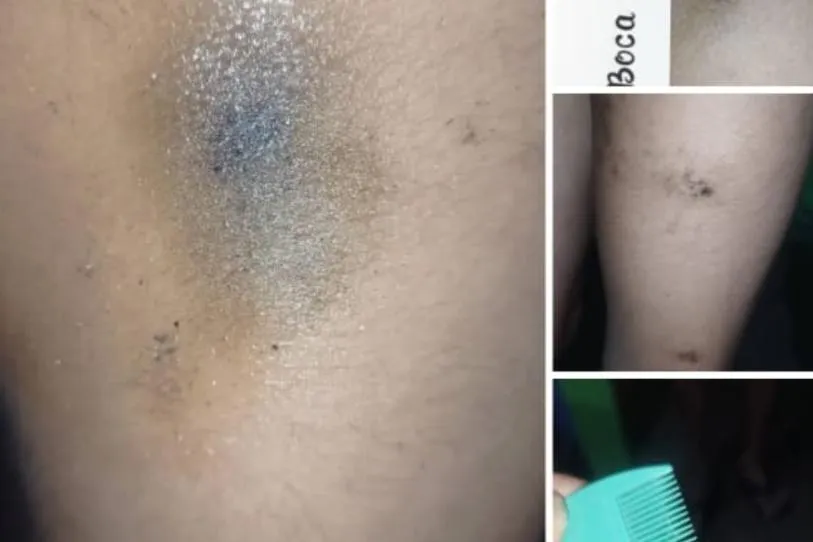 Chapopote ya afecta a turistas