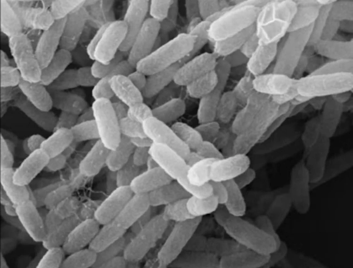Aterra fuga de peste en laboratorio en Siberia